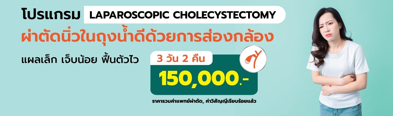 ผ่าตัดนิ่วในถุงน้ำดีด้วยการส่องกล้อง