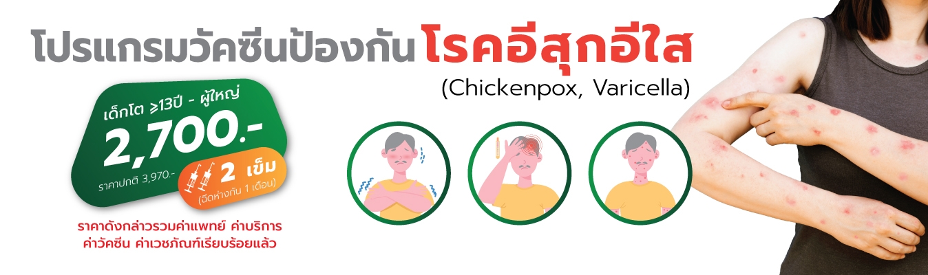 โปรแกรมวัคซีนป้องกันโรคอีสุก อีใส (Varicella-Zoster virus, VZV)