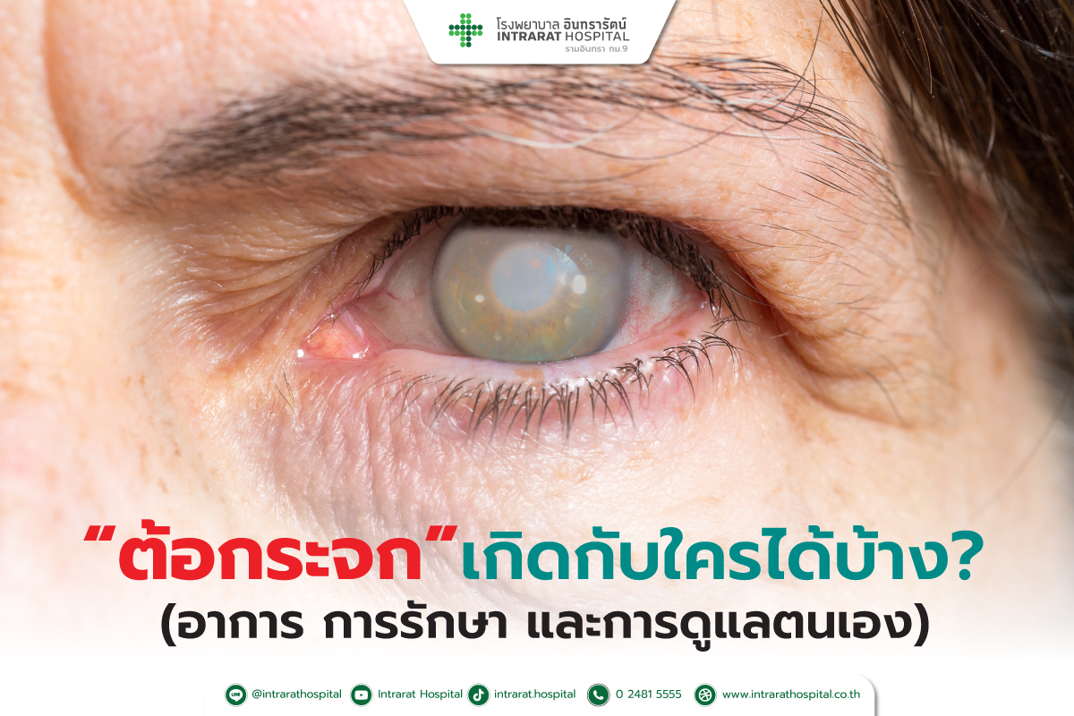 โรคต้อกระจก (Cataract) 