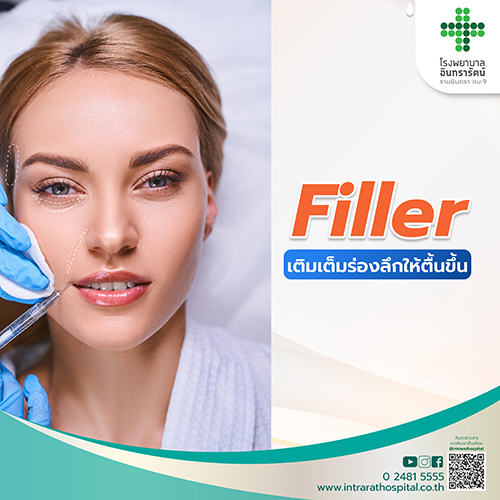 โปรแกรมเติมเต็มร่องลึกด้วย Filler