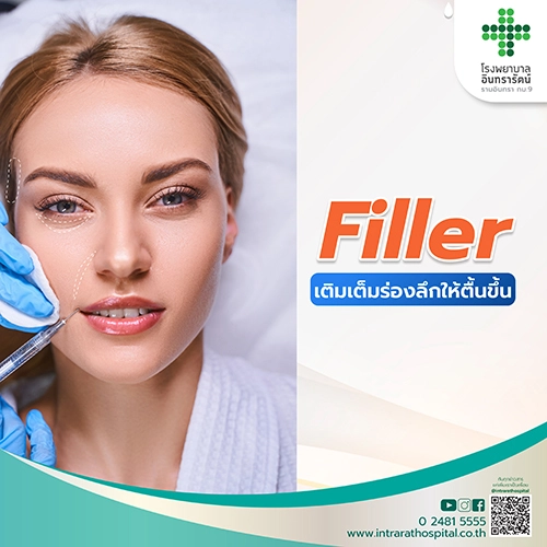 โปรแกรมเติมเต็มร่องลึกด้วย Filler
