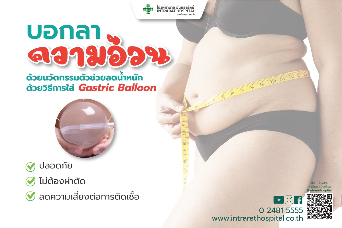 “ลดอ้วน…ด้วยบอลลูน”   ใส่บอลลูนลดน้ำหนักโดยไม่ต้องผ่าตัด