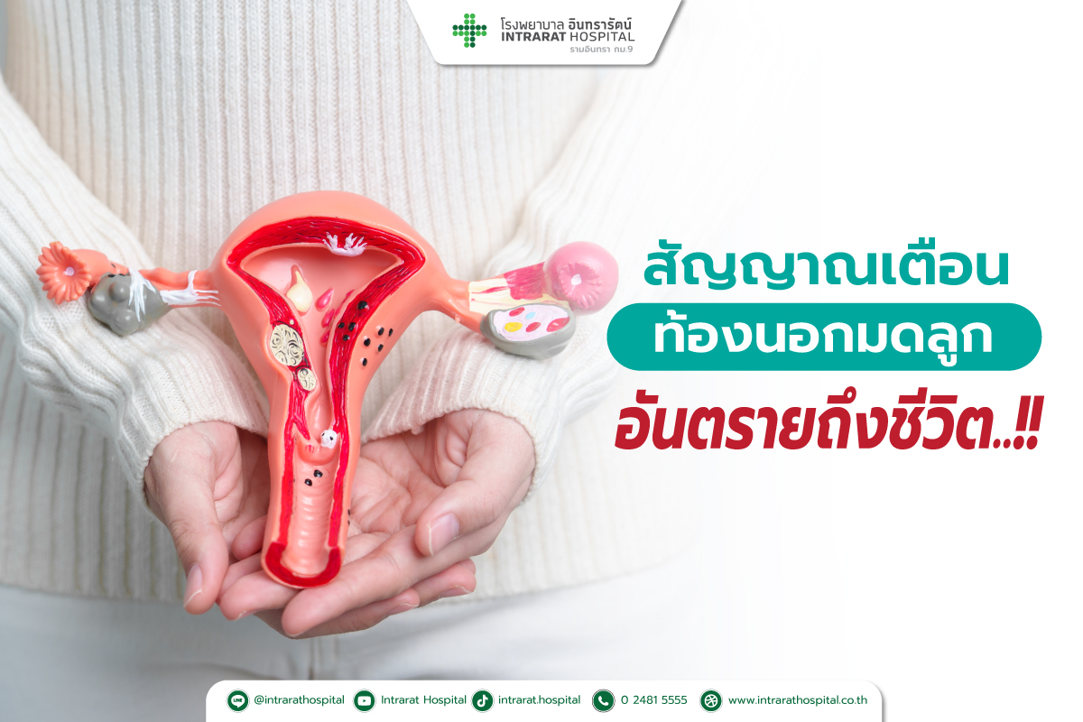 การตั้งครรภ์นอกมดลูก