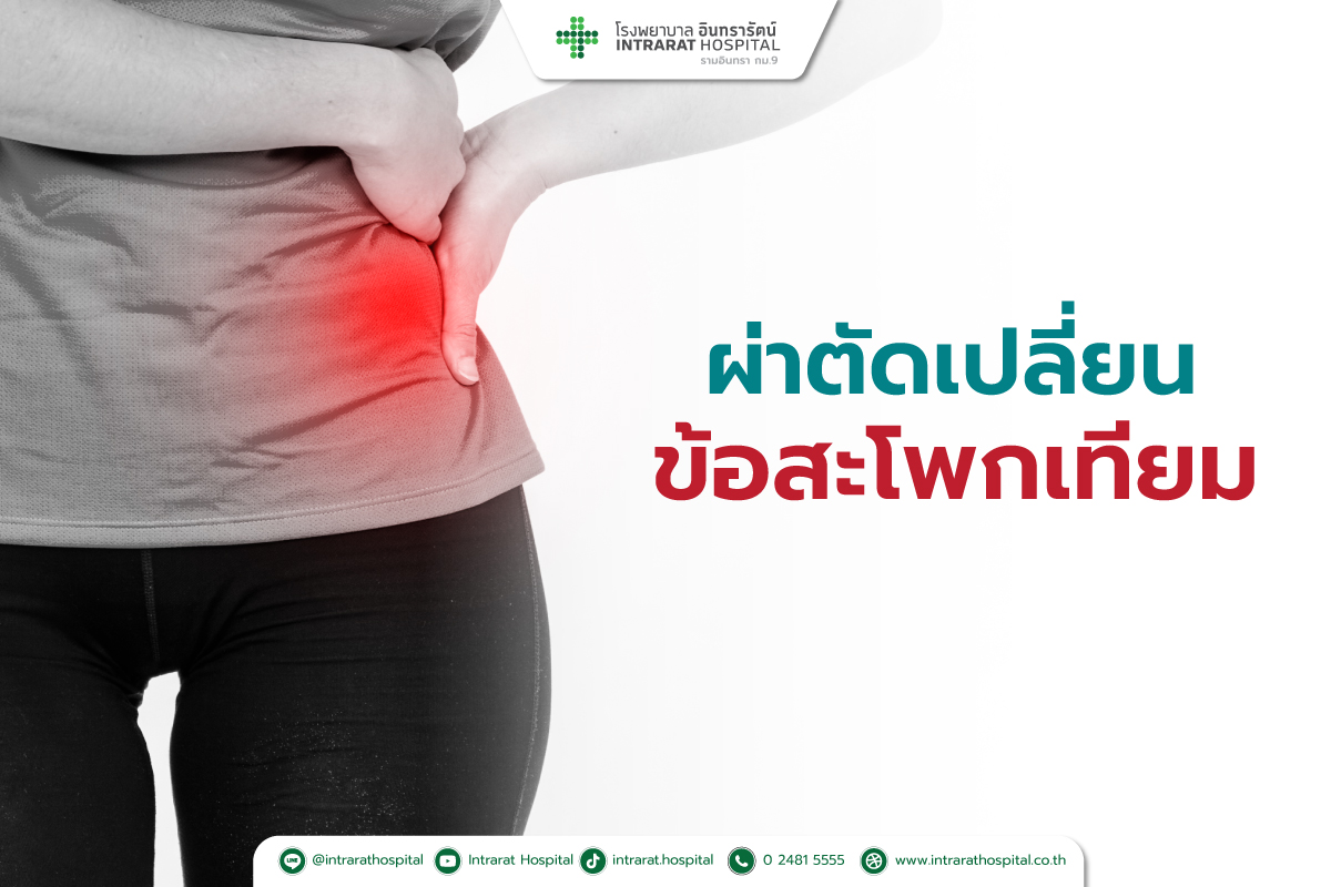 การผ่าตัดเปลี่ยนข้อสะโพกเทียม