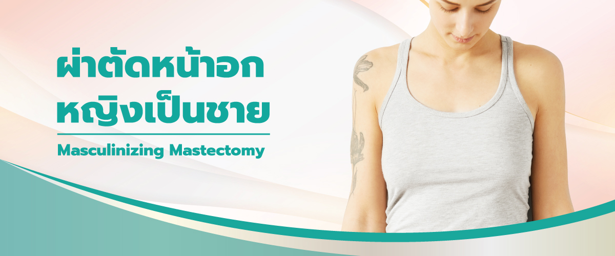 การเปลี่ยนนมหญิงเป็นชาย (Masculinizing Mastectomy)