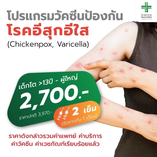 โปรแกรมวัคซีนป้องกันโรคอีสุก อีใส (Varicella-Zoster virus, VZV)
