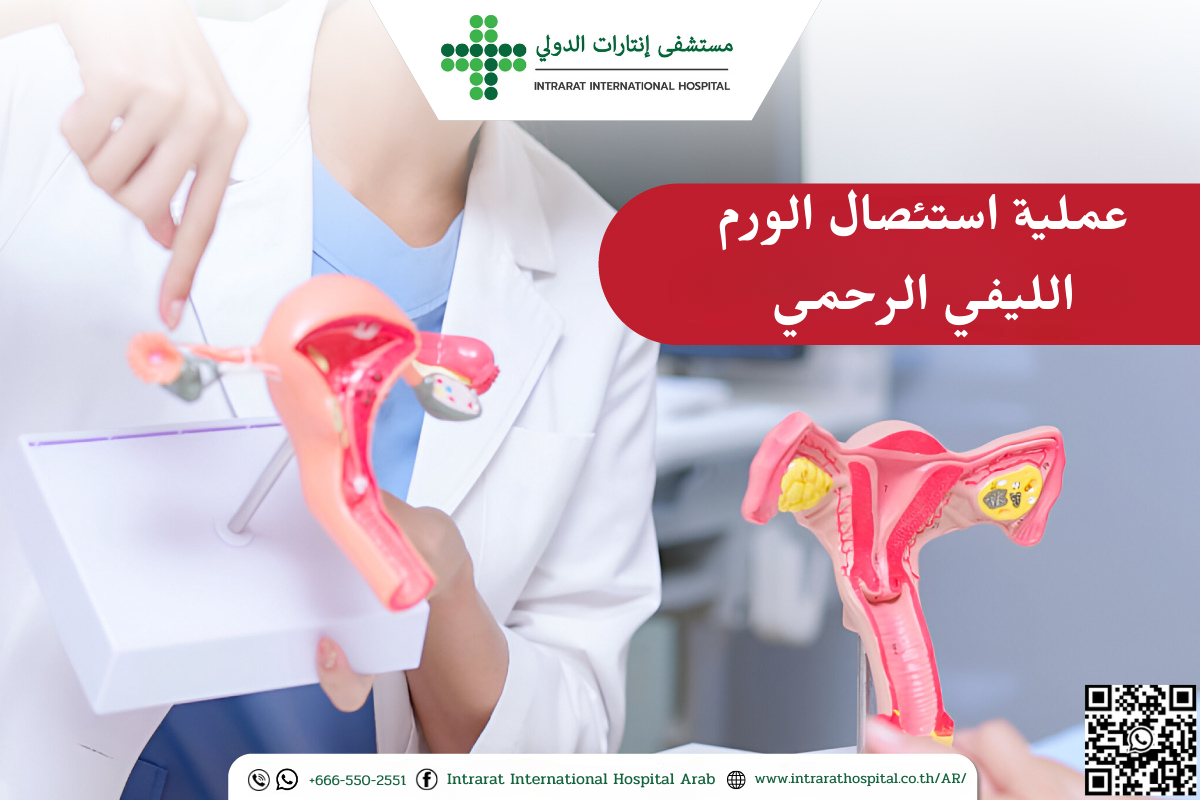  (Myomectomy)  عملية استئصال الورم الليفي الرحمي 