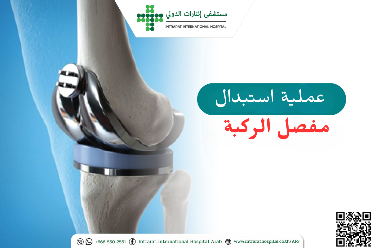 عملية استبدال مفصل الركبة