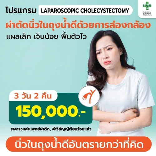 ผ่าตัดนิ่วในถุงน้ำดีด้วยการส่องกล้อง LAPAROSCOPIC  CHOLECYSTECTOMY
