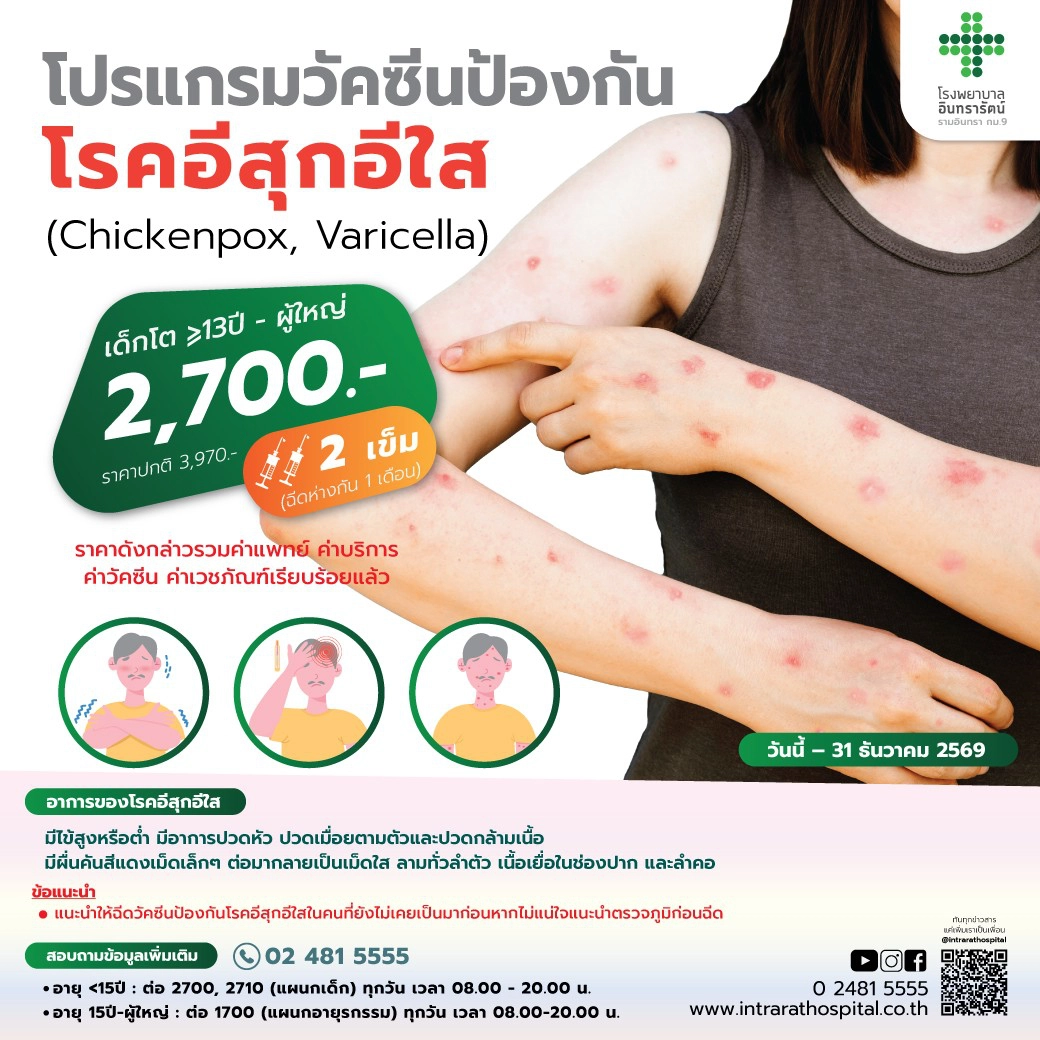 โปรแกรมวัคซีนป้องกันโรคอีสุก อีใส (Varicella-Zoster virus, VZV)