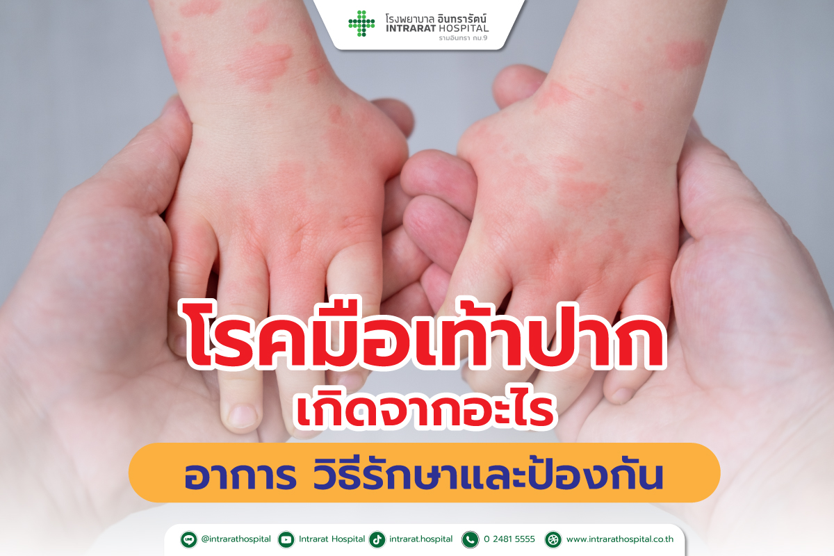 โรคมือเท้าปาก เกิดจากอะไร อาการ วิธีรักษาและป้องกัน